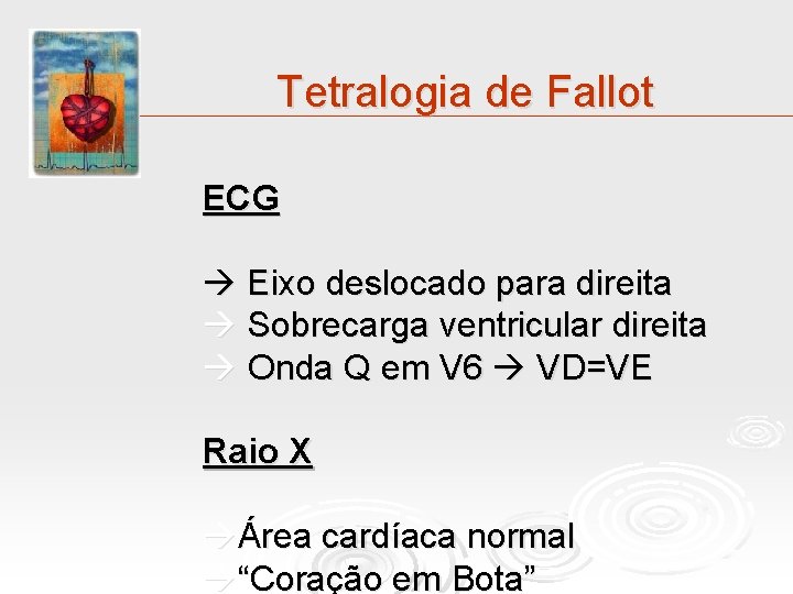 Tetralogia de Fallot ECG Eixo deslocado para direita Sobrecarga ventricular direita Onda Q em