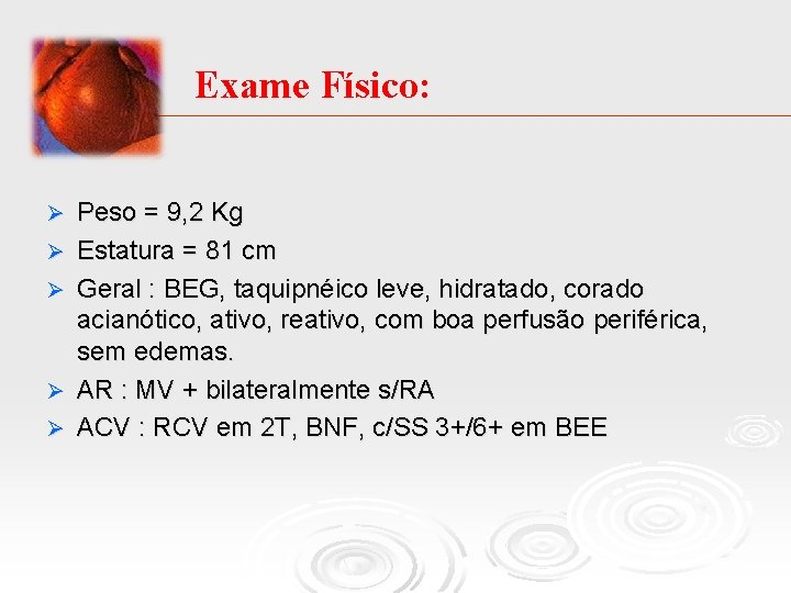 Exame Físico: Ø Ø Ø Peso = 9, 2 Kg Estatura = 81 cm