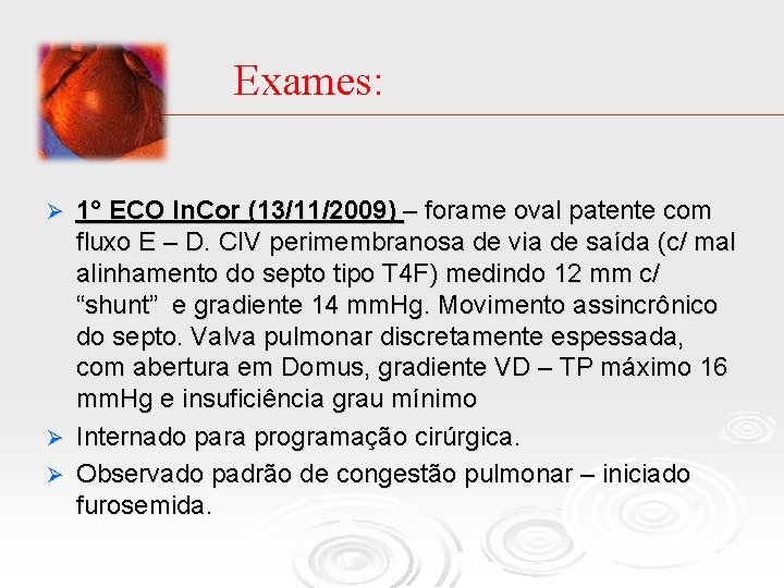 Exames: 1° ECO In. Cor (13/11/2009) – forame oval patente com fluxo E –