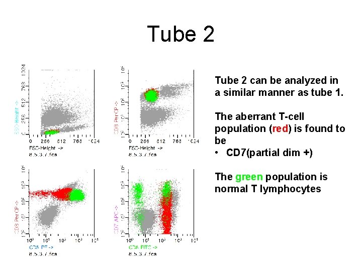 Tube 2 can be analyzed in a similar manner as tube 1. The aberrant