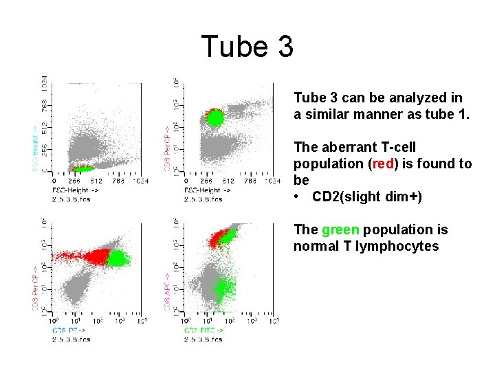 Tube 3 can be analyzed in a similar manner as tube 1. The aberrant