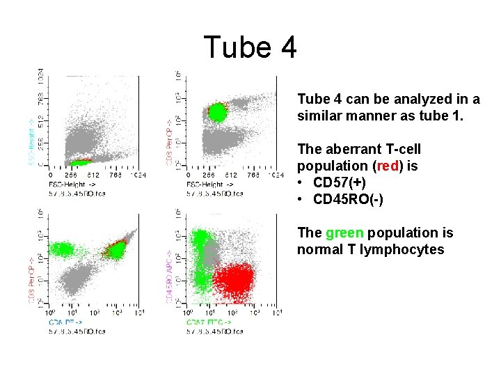 Tube 4 can be analyzed in a similar manner as tube 1. The aberrant