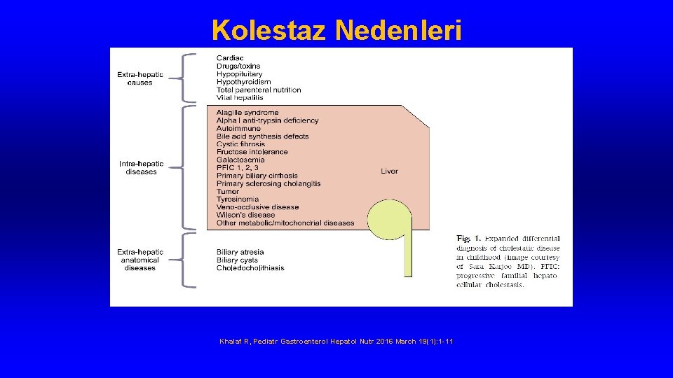 Kolestaz Nedenleri Khalaf R, Pediatr Gastroenterol Hepatol Nutr 2016 March 19(1): 1 -11 