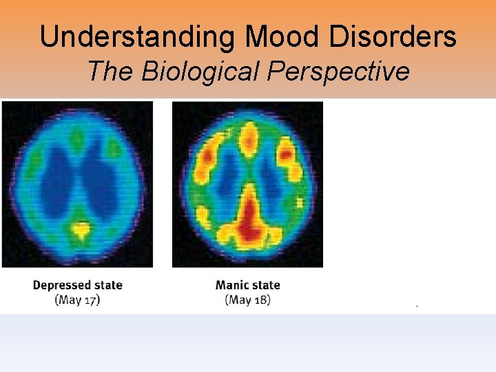 Understanding Mood Disorders The Biological Perspective 