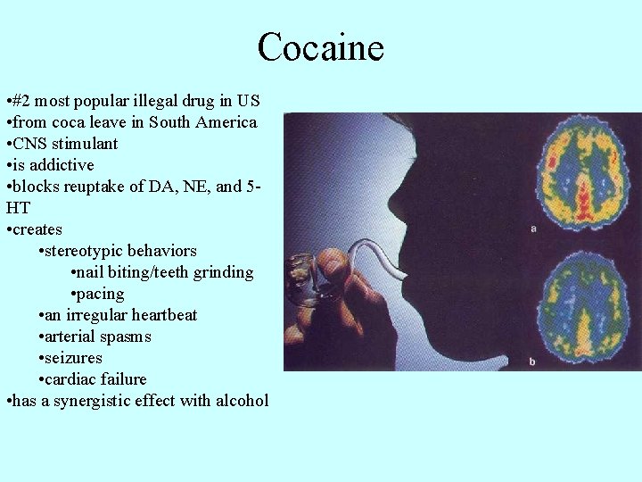 Cocaine • #2 most popular illegal drug in US • from coca leave in