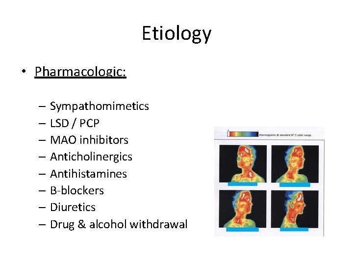 Etiology • Pharmacologic: – Sympathomimetics – LSD / PCP – MAO inhibitors – Anticholinergics