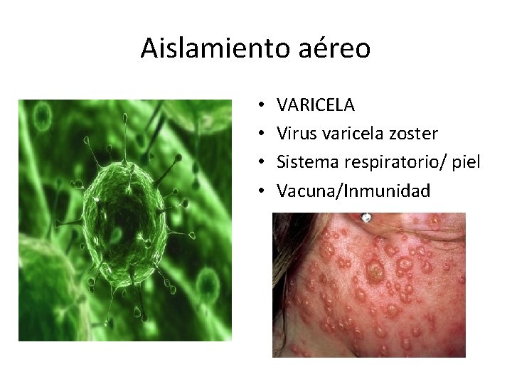 Aislamiento aéreo • • • VARICELA Virus varicela zoster Sistema respiratorio/ piel Vacuna/Inmunidad 