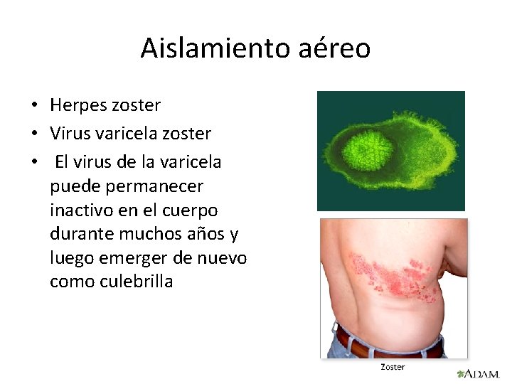 Aislamiento aéreo • Herpes zoster • Virus varicela zoster • El virus de la Aislamiento aéreo • Herpes zoster • Virus varicela zoster • El virus de la
