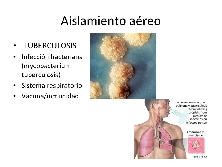 Aislamiento aéreo • TUBERCULOSIS • Infección bacteriana (mycobacterium tuberculosis) • Sistema respiratorio • Vacuna/inmunidad