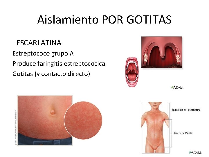 Aislamiento POR GOTITAS ESCARLATINA Estreptococo grupo A Produce faringitis estreptococica Gotitas (y contacto directo) Aislamiento POR GOTITAS ESCARLATINA Estreptococo grupo A Produce faringitis estreptococica Gotitas (y contacto directo)