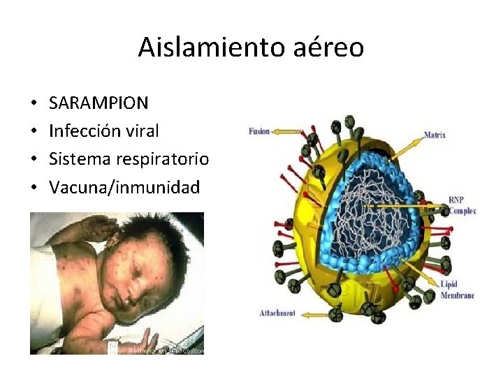 Aislamiento aéreo • • SARAMPION Infección viral Sistema respiratorio Vacuna/inmunidad 