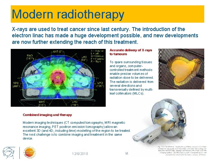 Modern radiotherapy X-rays are used to treat cancer since last century. The introduction of