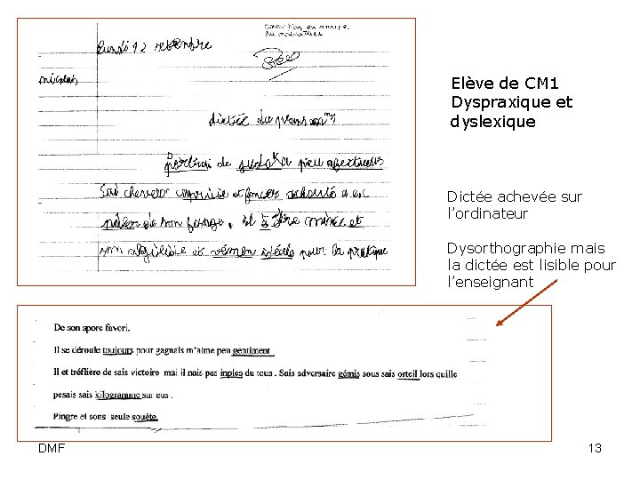 Elève de CM 1 Dyspraxique et dyslexique Dictée achevée sur l’ordinateur Dysorthographie mais la