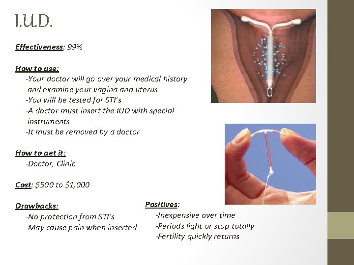 I. U. D. Effectiveness: 99% How to use: -Your doctor will go over your I. U. D. Effectiveness: 99% How to use: -Your doctor will go over your