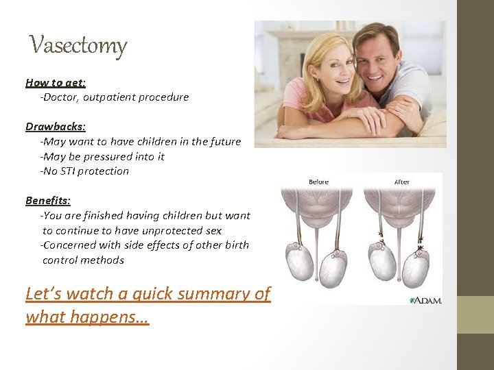 Vasectomy How to get: -Doctor, outpatient procedure Drawbacks: -May want to have children in Vasectomy How to get: -Doctor, outpatient procedure Drawbacks: -May want to have children in