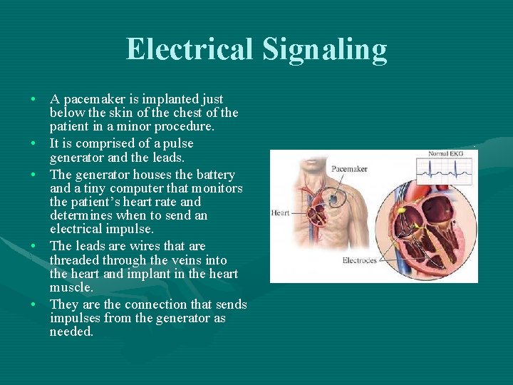 Electrical Signaling • A pacemaker is implanted just below the skin of the chest