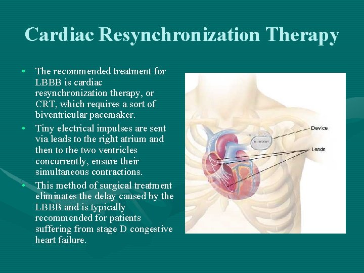 Cardiac Resynchronization Therapy • The recommended treatment for LBBB is cardiac resynchronization therapy, or