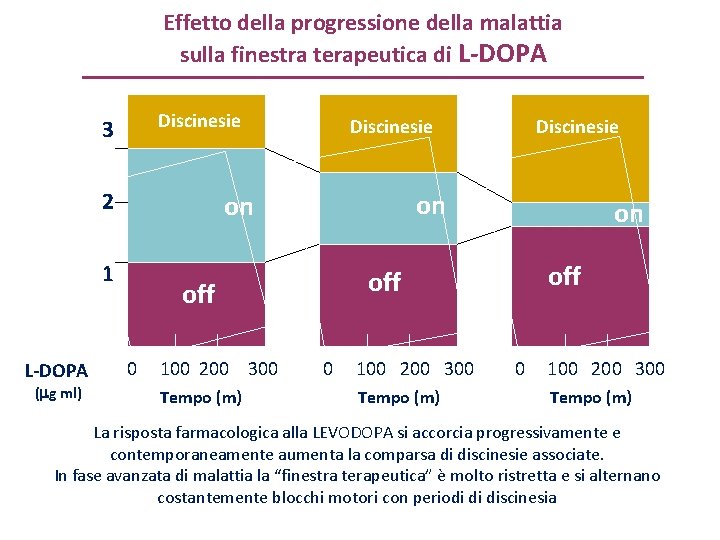 Effetto della progressione della malattia sulla finestra terapeutica di L-DOPA Discinesie 3 2 (