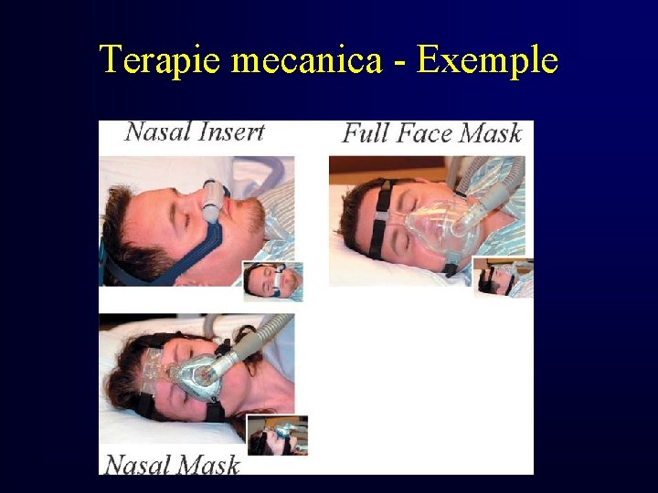 Terapie mecanica - Exemple 