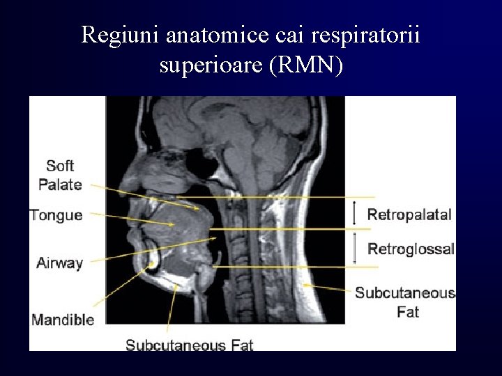 Regiuni anatomice cai respiratorii superioare (RMN) 