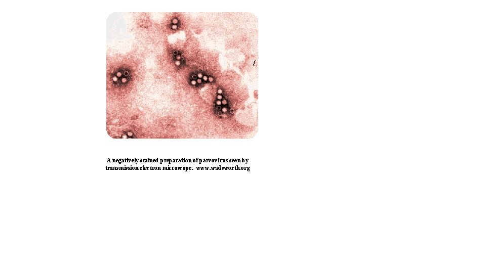 A negatively stained preparation of parvovirus seen by transmission electron microscope. www. wadsworth. org