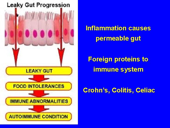 Inflammation causes permeable gut Foreign proteins to immune system Crohn’s, Colitis, Celiac 