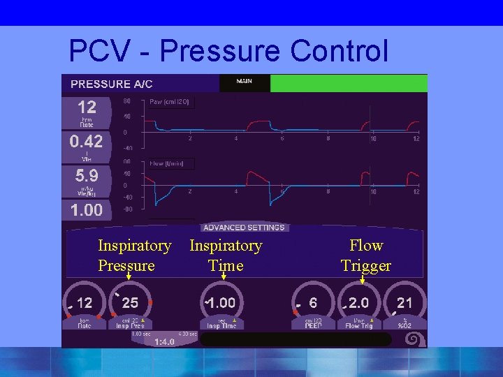 PCV - Pressure Control Inspiratory Pressure Inspiratory Time Flow Trigger 