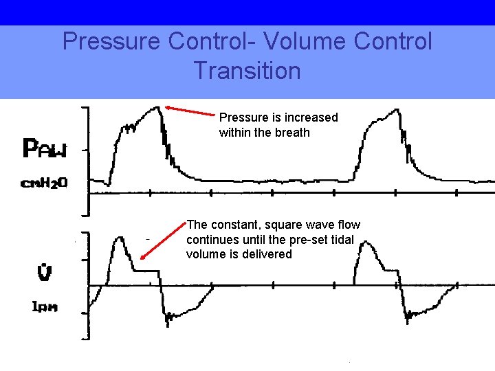 Pressure Control- Volume Control Transition Pressure is increased within the breath The constant, square