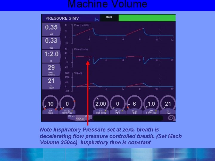 Machine Volume Note Inspiratory Pressure set at zero, breath is decelerating flow pressure controlled