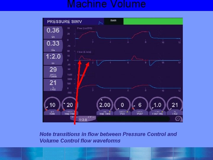 Machine Volume Note transitions in flow between Pressure Control and Volume Control flow waveforms