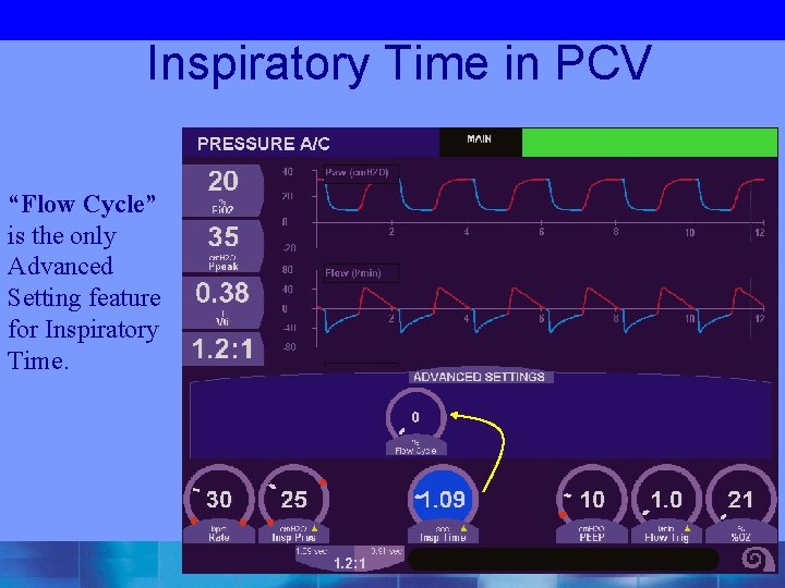  Inspiratory Time in PCV “Flow Cycle” is the only Advanced Setting feature for