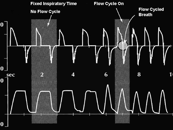 Fixed Inspiratory Time No Flow Cycle On Flow Cycled Breath 
