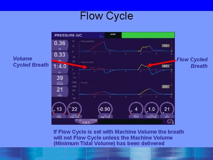 Flow Cycle Volume Cycled Breath Flow Cycled Breath If Flow Cycle is set with