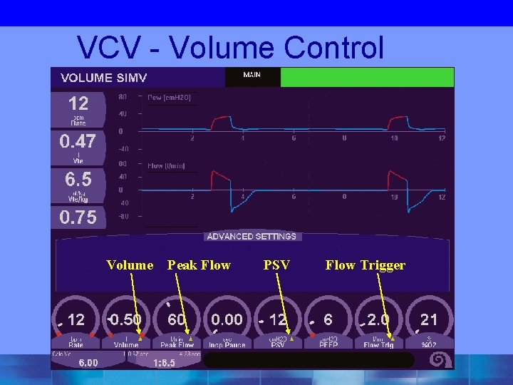 VCV - Volume Control Volume Peak Flow PSV Flow Trigger 