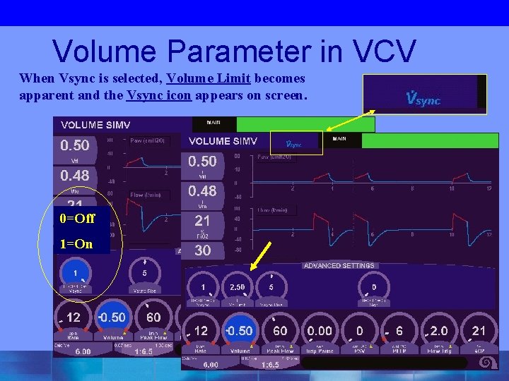 Volume Parameter in VCV When Vsync is selected, Volume Limit becomes apparent and the