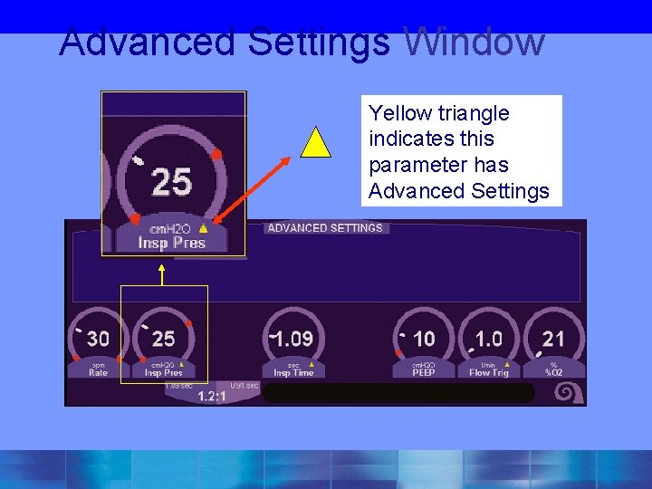 Advanced Settings Window Yellow triangle indicates this parameter has Advanced Settings 