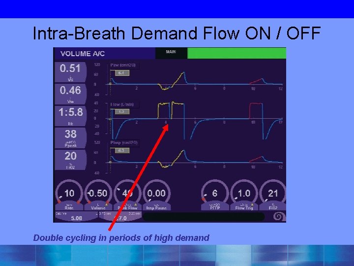 Intra-Breath Demand Flow ON / OFF Double cycling in periods of high demand 