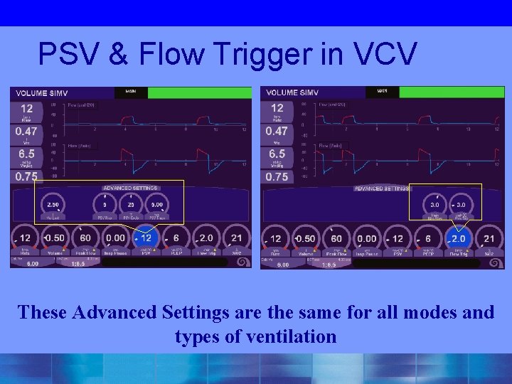 PSV & Flow Trigger in VCV These Advanced Settings are the same for all