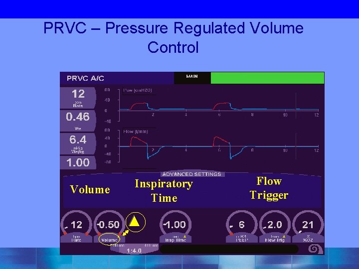 PRVC – Pressure Regulated Volume Control Volume Inspiratory Time Flow Trigger 