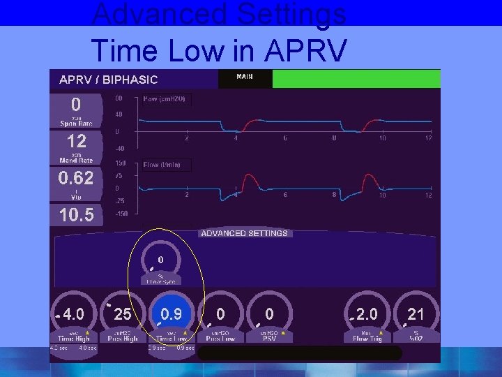 Advanced Settings Time Low in APRV 