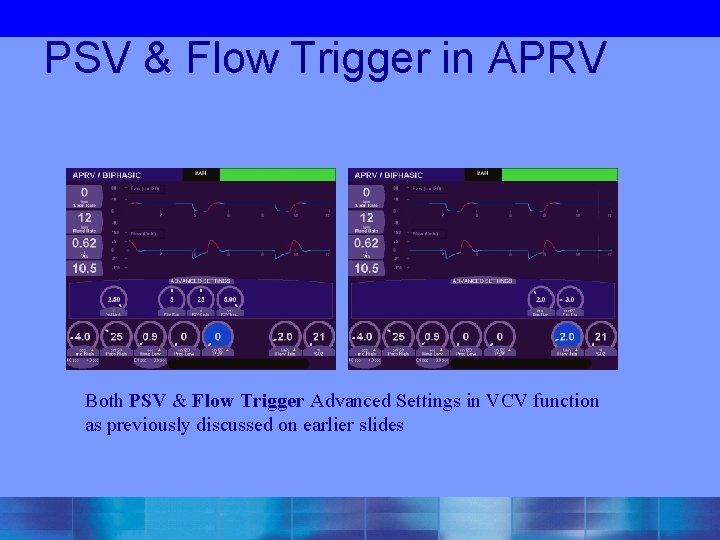 PSV & Flow Trigger in APRV Both PSV & Flow Trigger Advanced Settings in