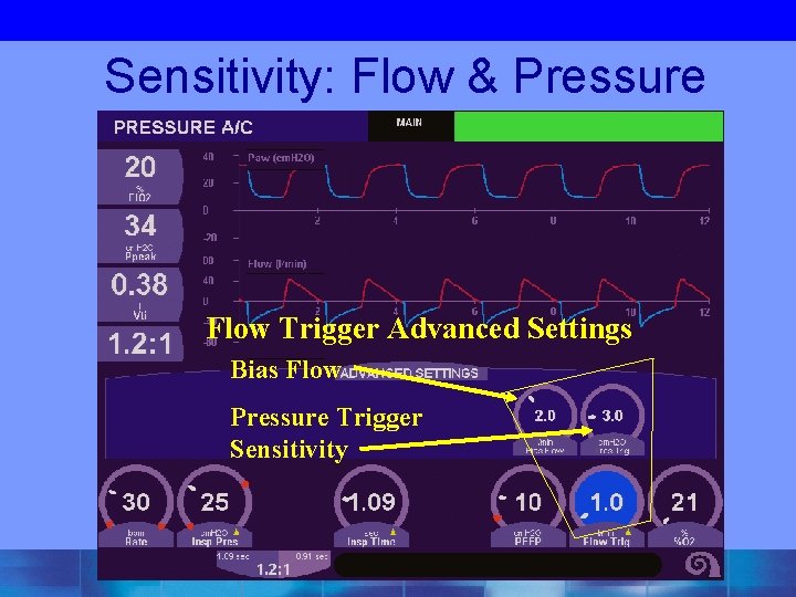 Sensitivity: Flow & Pressure Flow Trigger Advanced Settings Bias Flow Pressure Trigger Sensitivity 