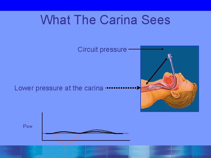 What The Carina Sees Circuit pressure Lower pressure at the carina Paw 