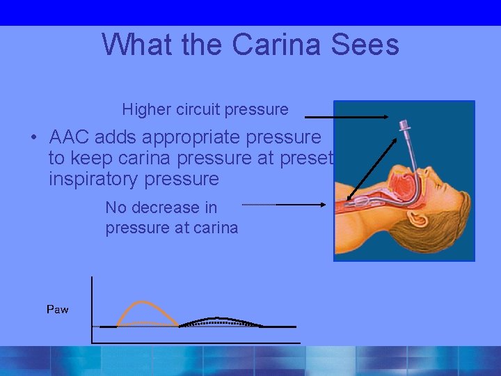 What the Carina Sees Higher circuit pressure • AAC adds appropriate pressure to keep