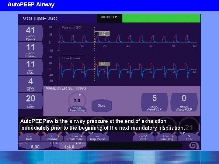 Auto. PEEP Airway Auto. PEEPaw is the airway pressure at the end of exhalation