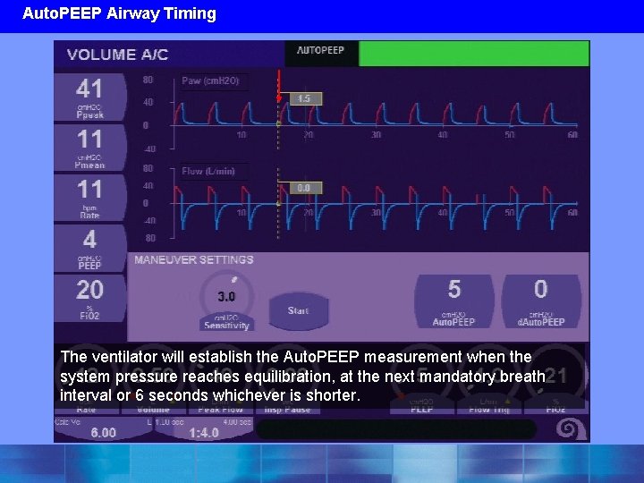 Auto. PEEP Airway Timing The ventilator will establish the Auto. PEEP measurement when the