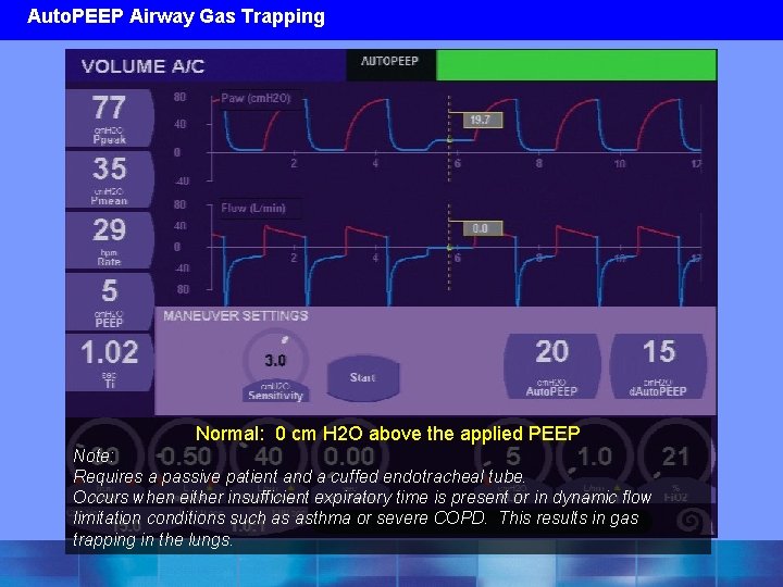 Auto. PEEP Airway Gas Trapping Normal: 0 cm H 2 O above the applied