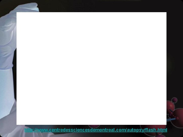 http: //www. centredessciencesdemontreal. com/autopsy/flash. html 33 