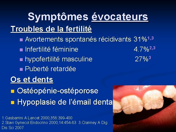 Symptômes évocateurs Troubles de la fertilité Avortements spontanés récidivants 31%1, 3 n Infertilité féminine