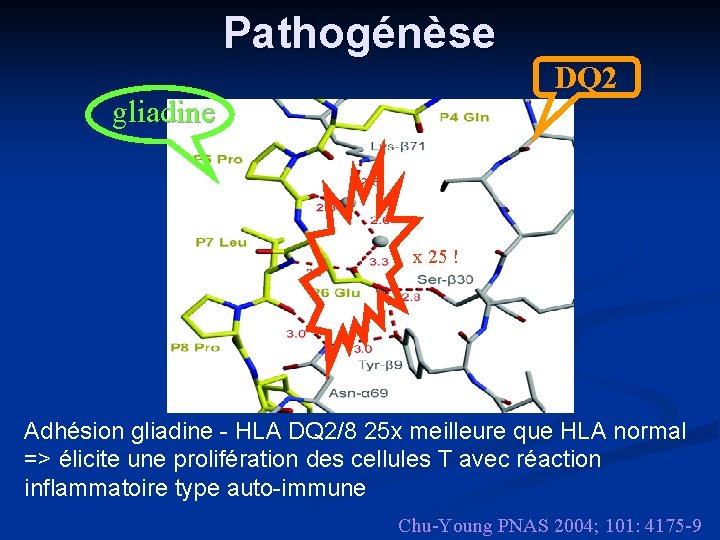 Pathogénèse DQ 2 gliadine x 25 ! Adhésion gliadine - HLA DQ 2/8 25